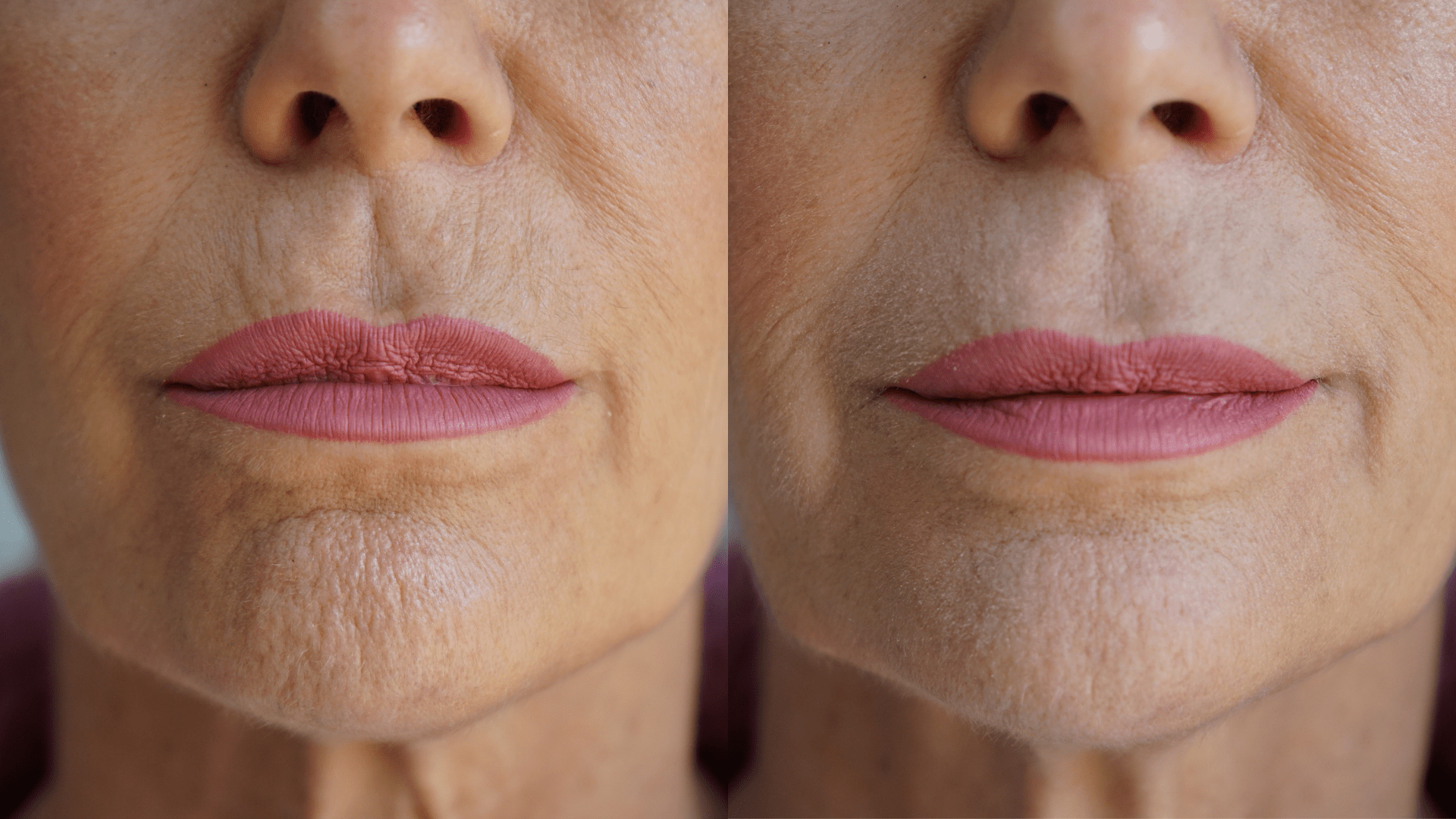Ageless Lip & Line Filler - FiveBeelow