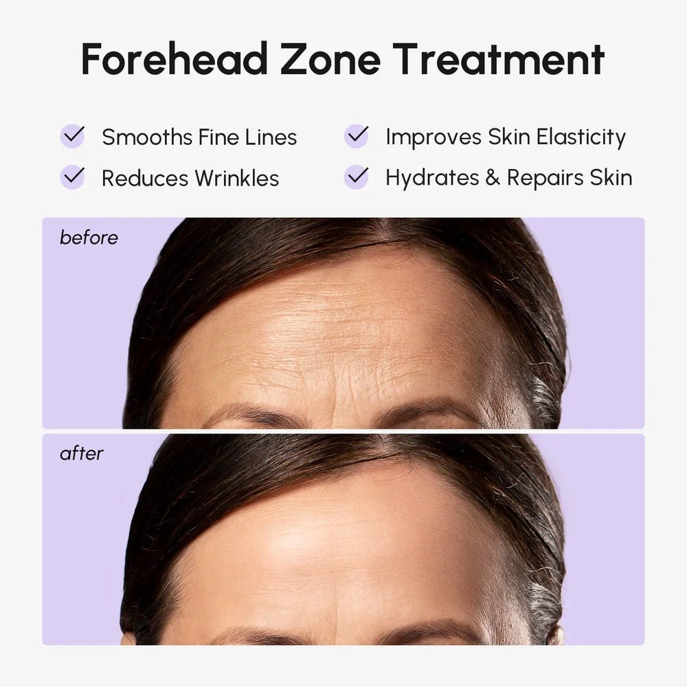 Anti-Wrinkle Forehead Patches - FiveBeelow