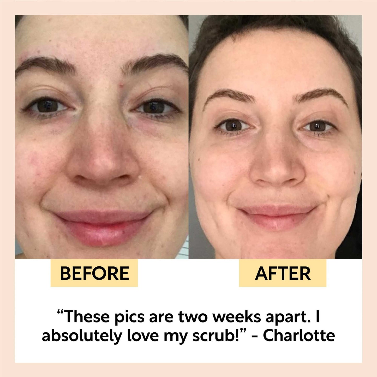 Travel-Size Skincare Bundle - FiveBeelow
